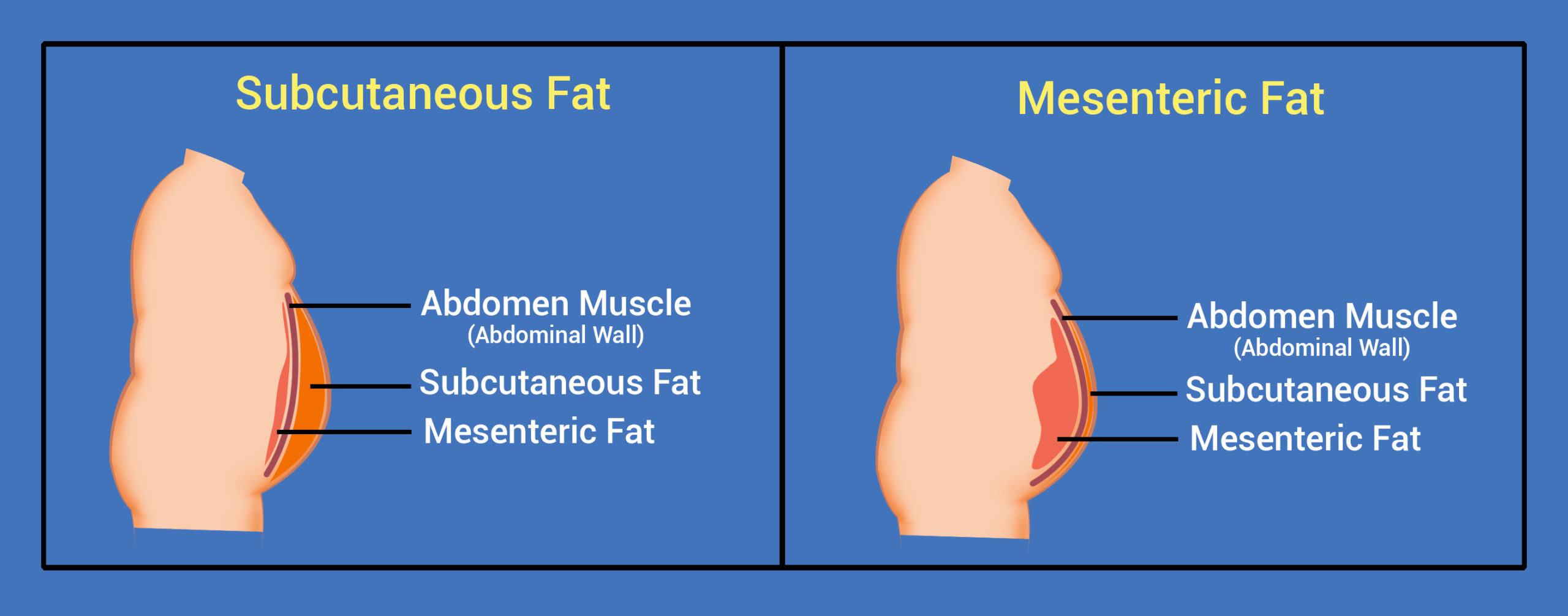 Subcutaneous fat and weight management