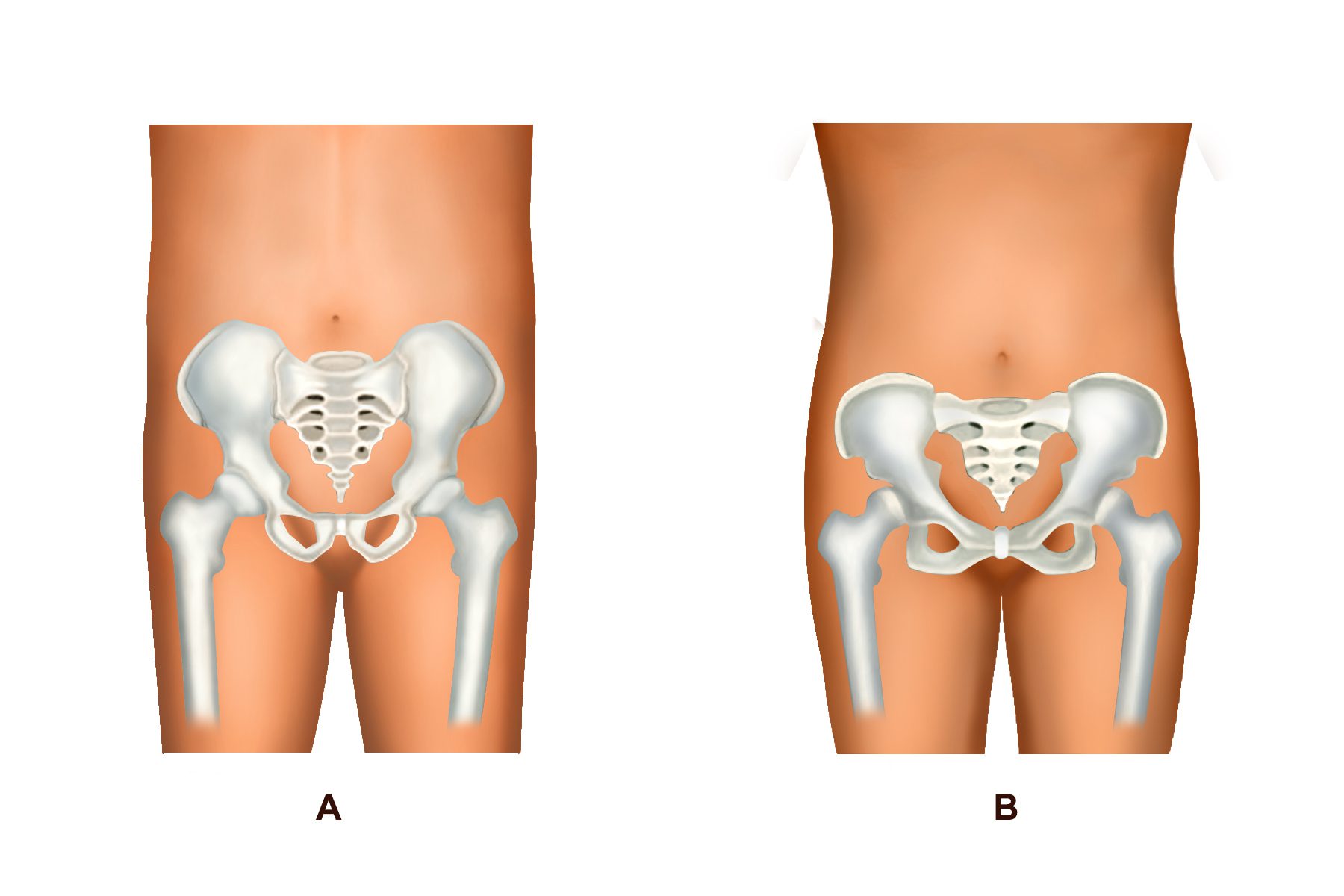 Three In-demand Body Contouring Procedures